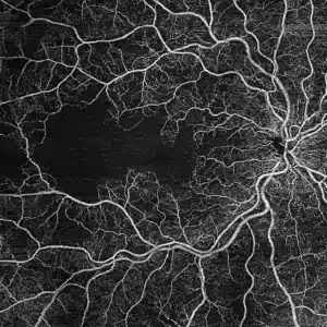 OCT-angiographie